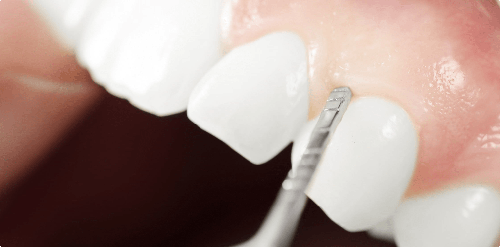 Drs Christian Maire et Zacharie Lang Parodontologie