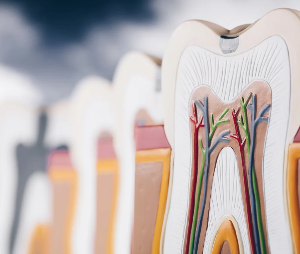 Traitement de racine(s) au cabinet dentaire du Dr Maire à Lisbonne. Endodontie